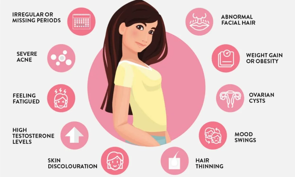 Mengenal PCOS Inflamasi: Ketidakseimbangan Hormon Bertemu