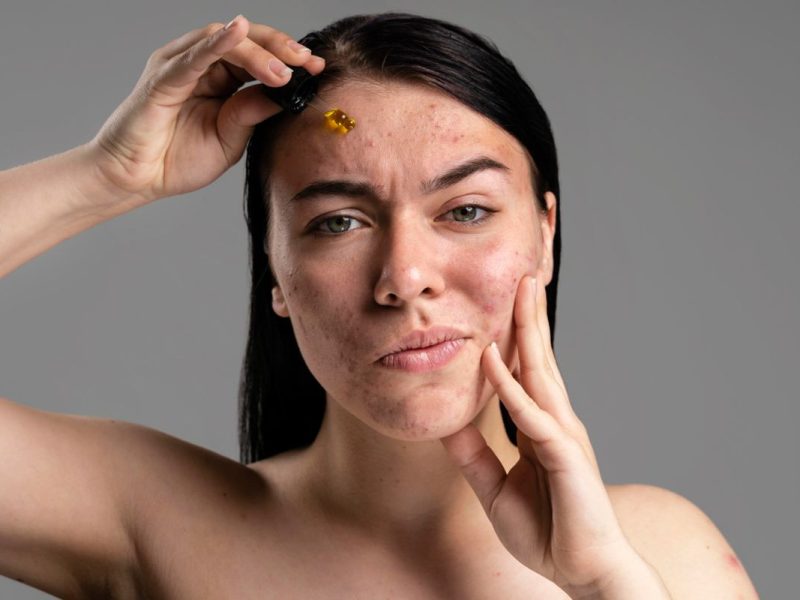 4 Skincare Andalan Penghilang Flek Hitam, Retinol Wajib Coba!