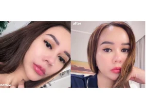 Rahasia Perubahan Wajah Aura Kasih