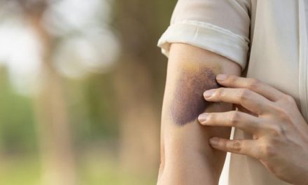 Efek Samping Suntik Putih Bagi Kesehatan