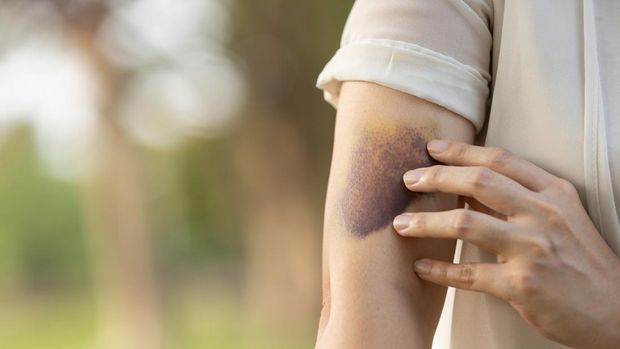 Efek Samping Suntik Putih Bagi Kesehatan